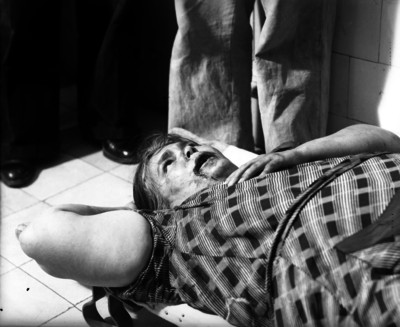 Cadáver de una mujer con sangre en la boca