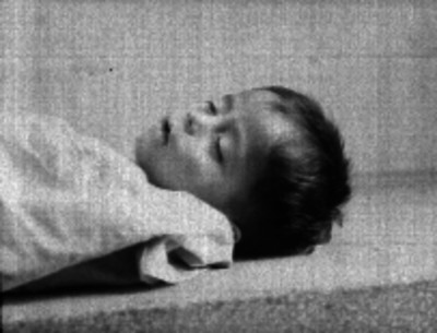 Cadáver de un niño en una plancha del anfiteatro