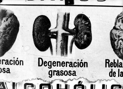 "Degeración grasosa", ilustración de un libro
