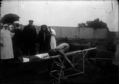 Cadáver sobre una plancha