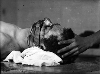 Cadáver estudiado por un médico