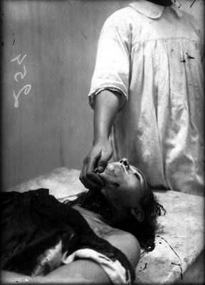 Médico mostrando la herida de una mujer degollada